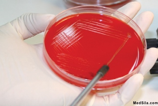 Секторальный посев мочи