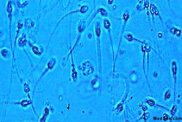 Сперматозоиды под микроскопом